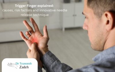 Trigger Finger explained: causes, risk factors and innovative needle release technique