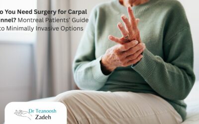 Do You Need Surgery for Carpal Tunnel? Montreal Patients’ Guide to Minimally Invasive Options