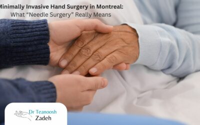 Minimally Invasive Hand Surgery in Montreal: What “Needle Surgery” Really Means